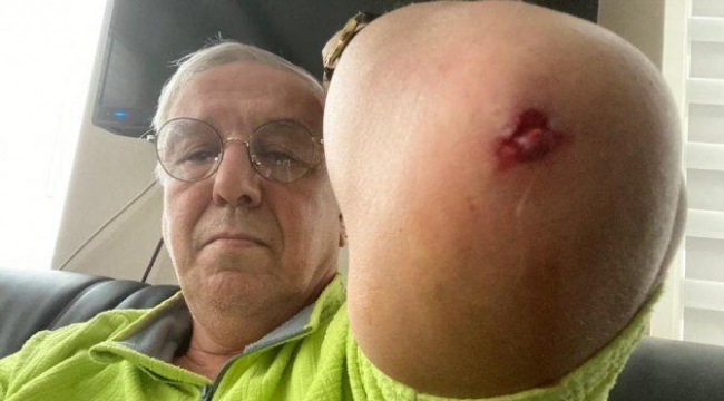  Ankara'da bir saldırı daha! Önce siyasetçi sonra da gazeteci dövüldü!
